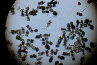 Viřnik 1l.(Brachionus sp.)